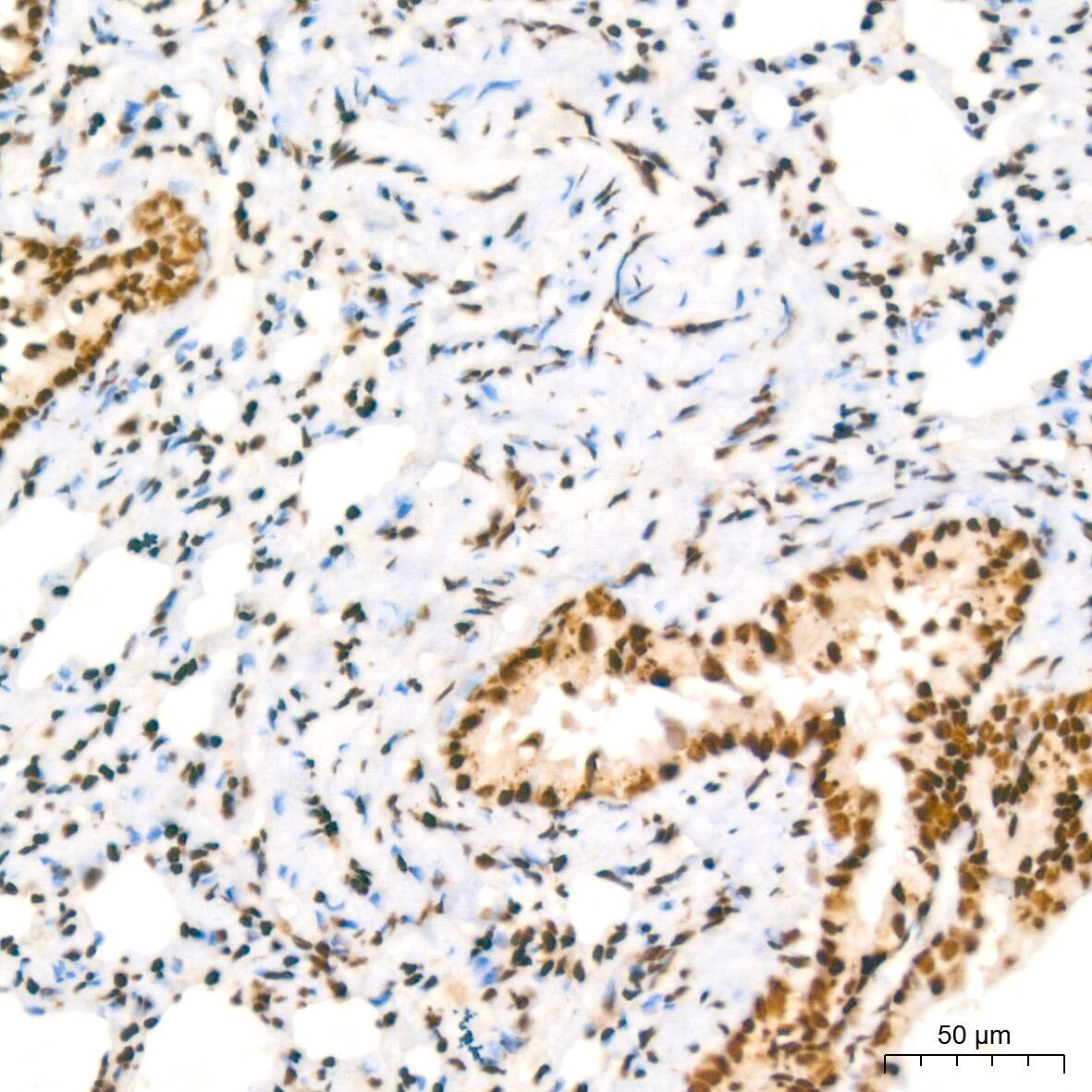 Immunohistochemistry: NuMA Antibody (6D4I4) [NBP3-16411] - Immunohistochemistry analysis of NuMA in paraffin-embedded rat lung tissue using NuMA Rabbit mAb  at a dilution of 1:200 (40x lens).High pressure antigen retrieval was performed with 0.01 M citrate buffer (pH 6.0) prior to IHC staining.