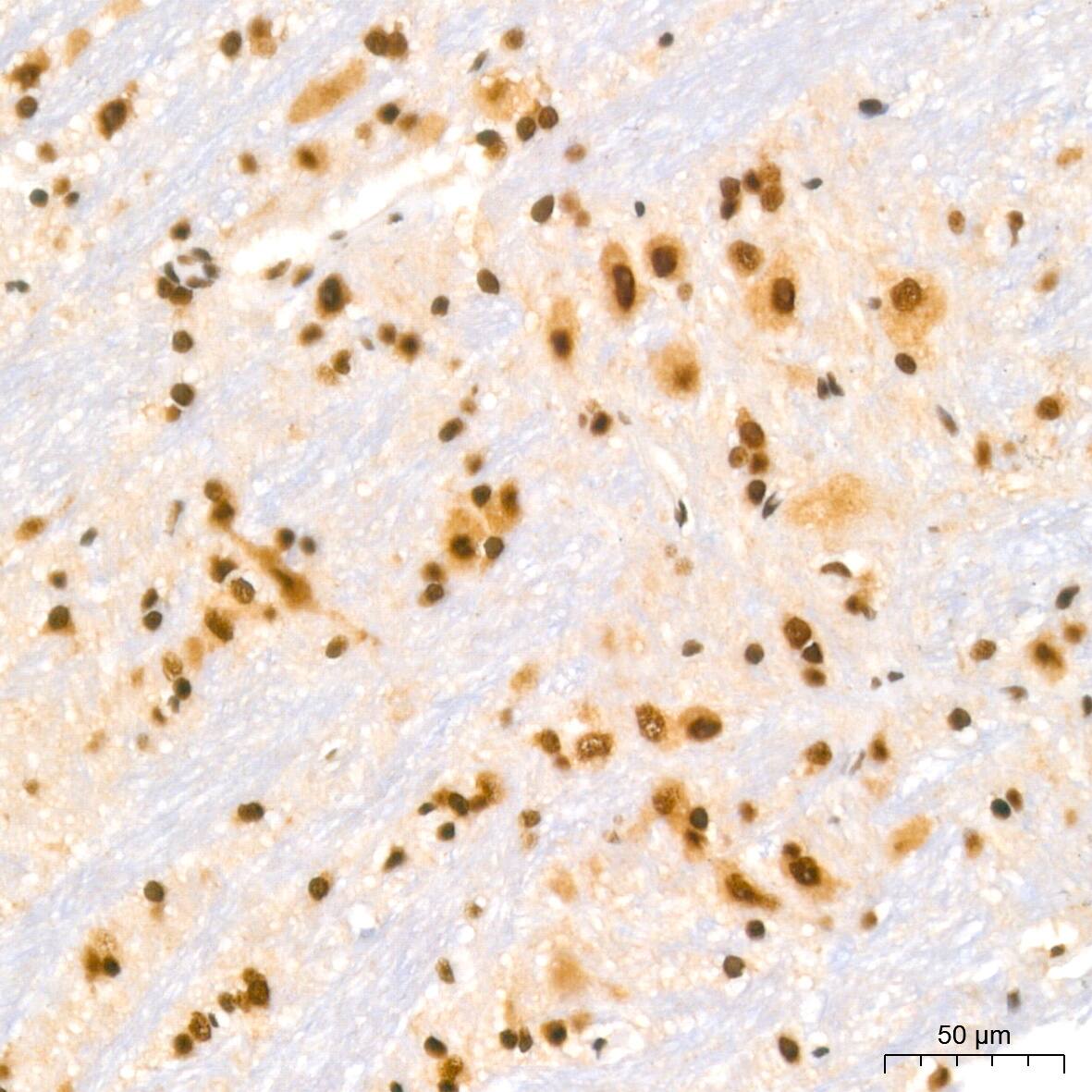 Immunohistochemistry: NuMA Antibody (6D4I4) [NBP3-16411] - Immunohistochemistry analysis of NuMA in paraffin-embedded rat brain tissue using NuMA Rabbit mAb  at a dilution of 1:200 (40x lens).High pressure antigen retrieval was performed with 0.01 M citrate buffer (pH 6.0) prior to IHC staining.