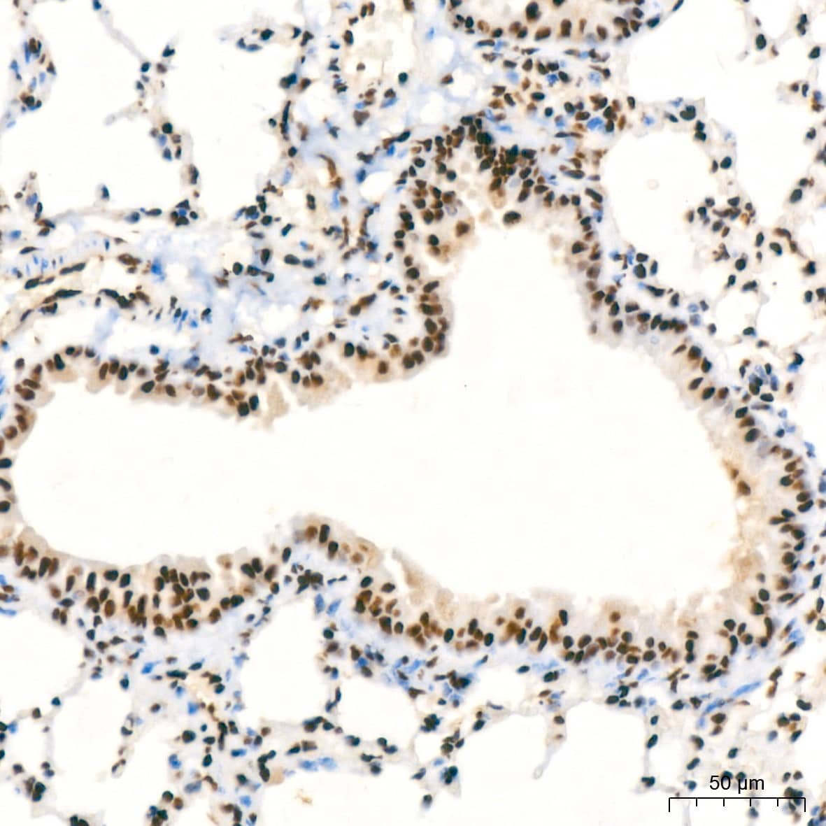 Immunohistochemistry: NuMA Antibody (6D4I4) [NBP3-16411] - Immunohistochemistry analysis of NuMA in paraffin-embedded mouse lung tissue using NuMA Rabbit mAb  at a dilution of 1:200 (40x lens).High pressure antigen retrieval was performed with 0.01 M citrate buffer (pH 6.0) prior to IHC staining.