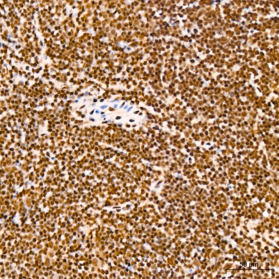 Immunohistochemistry: NuMA Antibody (6D4I4) [NBP3-16411] - Immunohistochemistry analysis of NuMA in paraffin-embedded mouse spleen tissue using NuMA Rabbit mAb  at a dilution of 1:200 (40x lens).High pressure antigen retrieval was performed with 0.01 M citrate buffer (pH 6.0) prior to IHC staining.