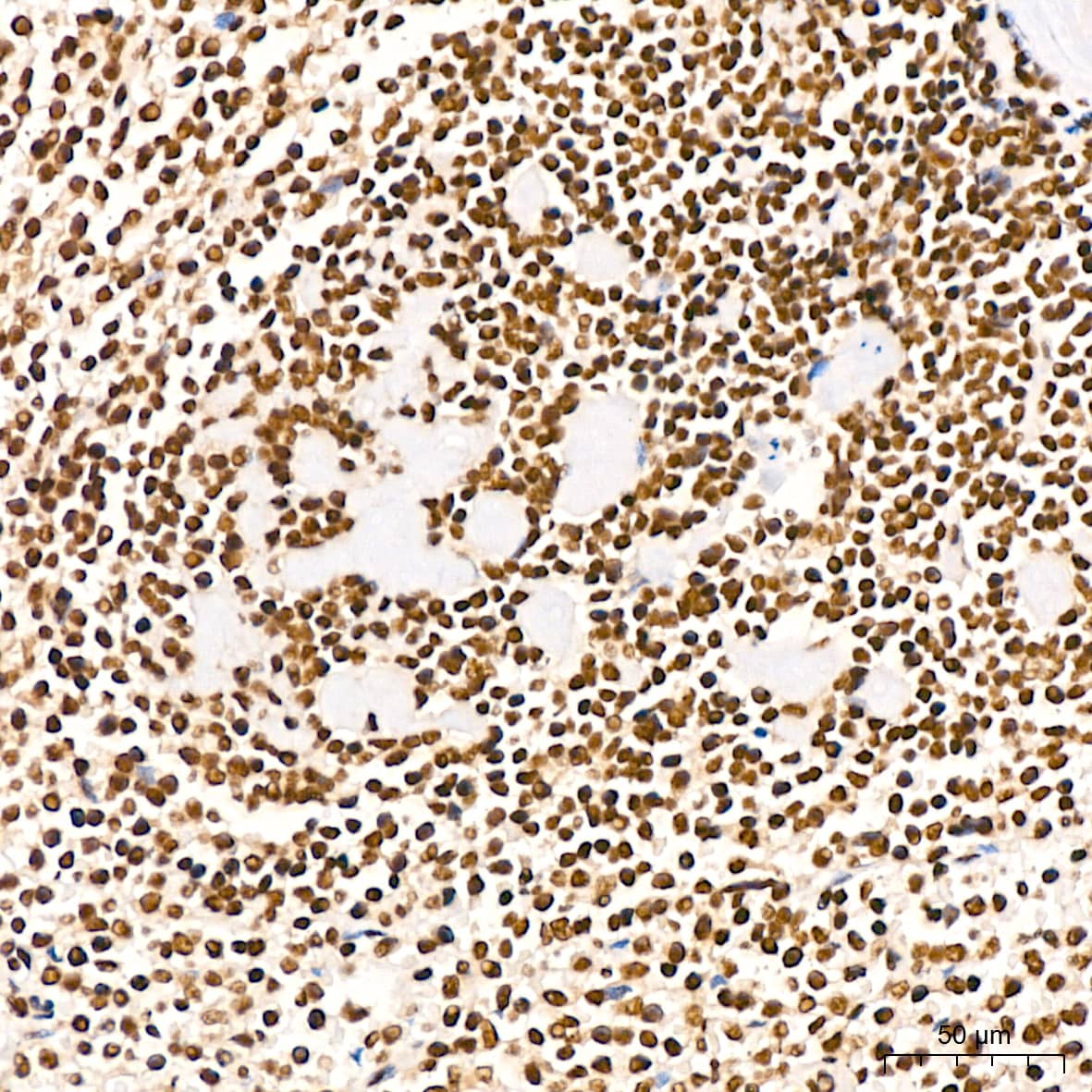 Immunohistochemistry: NuMA Antibody (6D4I4) [NBP3-16411] - Immunohistochemistry analysis of NuMA in paraffin-embedded human spleen tissue using NuMA Rabbit mAb  at a dilution of 1:200 (40x lens).High pressure antigen retrieval was performed with 0.01 M citrate buffer (pH 6.0) prior to IHC staining.