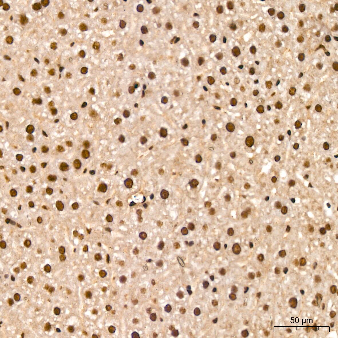 Immunohistochemistry: NuMA Antibody (6D4I4) [NBP3-16411] - Immunohistochemistry analysis of NuMA in paraffin-embedded mouse liver tissue using NuMA Rabbit mAb  at a dilution of 1:200 (40x lens).High pressure antigen retrieval was performed with 0.01 M citrate buffer (pH 6.0) prior to IHC staining.