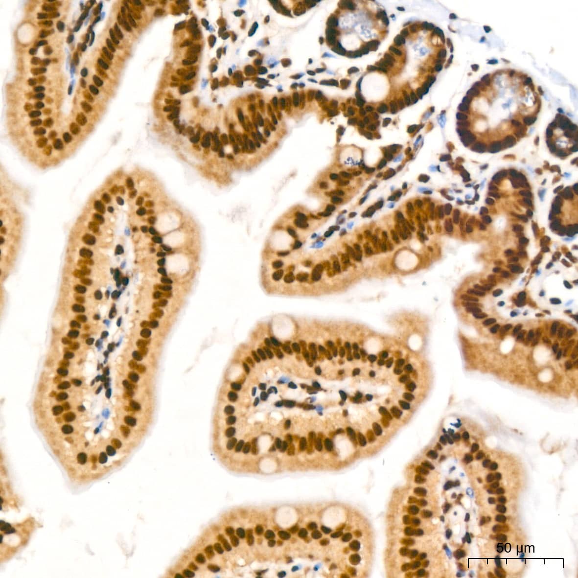 Immunohistochemistry: NuMA Antibody (6D4I4) [NBP3-16411] - Immunohistochemistry analysis of NuMA in paraffin-embedded mouse intestin tissue using NuMA Rabbit mAb  at a dilution of 1:200 (40x lens).High pressure antigen retrieval was performed with 0.01 M citrate buffer (pH 6.0) prior to IHC staining.