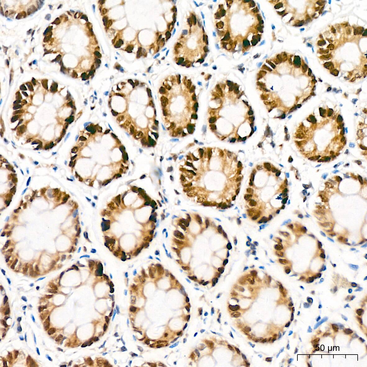 Immunohistochemistry: KAT1 Antibody (7U2O3) [NBP3-16412] - Immunohistochemistry analysis of KAT1 in paraffin-embedded human colon tissue using KAT1 Rabbit mAb  at a dilution of 1:200 (40x lens).High pressure antigen retrieval was performed with 0.01 M citrate buffer (pH 6.0) prior to IHC staining.