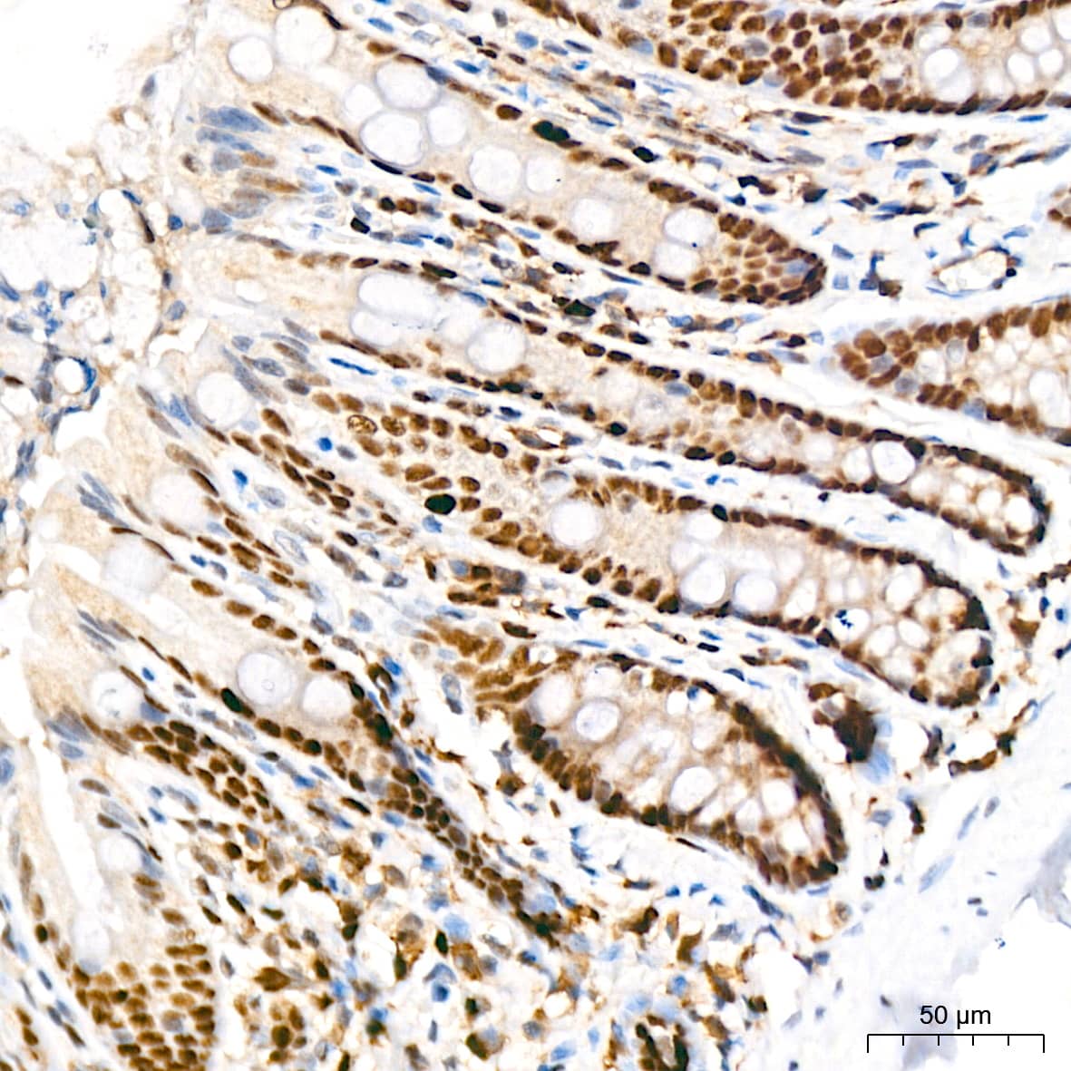 Immunohistochemistry: KAT1 Antibody (7U2O3) [NBP3-16412] - Immunohistochemistry analysis of KAT1 in paraffin-embedded rat colon tissue using KAT1 Rabbit mAb  at a dilution of 1:200 (40x lens).High pressure antigen retrieval was performed with 0.01 M citrate buffer (pH 6.0) prior to IHC staining.