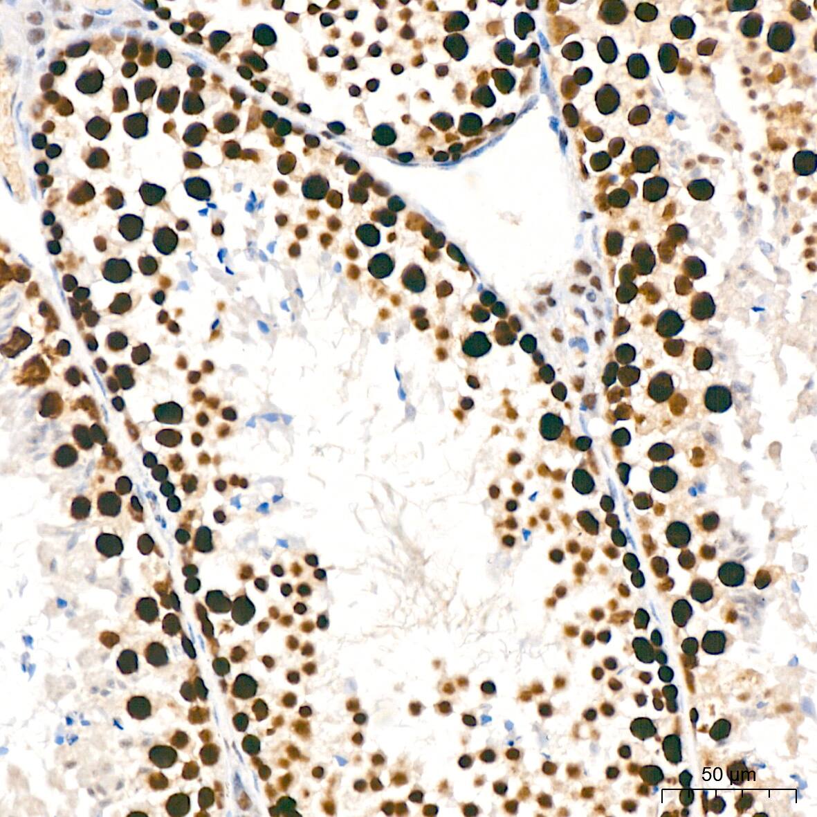 Immunohistochemistry: KAT1 Antibody (7U2O3) [NBP3-16412] - Immunohistochemistry analysis of KAT1 in paraffin-embedded mouse testis tissue using KAT1 Rabbit mAb  at a dilution of 1:200 (40x lens).High pressure antigen retrieval was performed with 0.01 M citrate buffer (pH 6.0) prior to IHC staining.