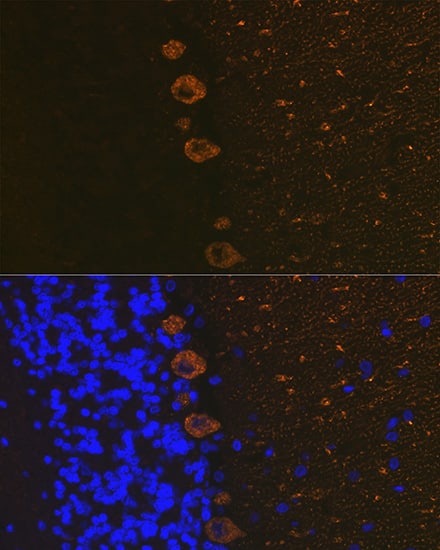 Immunocytochemistry/ Immunofluorescence: IP3R1 Antibody (4Z1B6) [NBP3-16414] - Immunofluorescence analysis of paraffin-embedded rat brain using IP3R1 Rabbit mAb at dilution of 1:100 (40x lens). Secondary antibody: Cy3-conjugated Goat anti-Rabbit IgG (H+L) at 1:500 dilution. Blue: DAPI for nuclear staining.