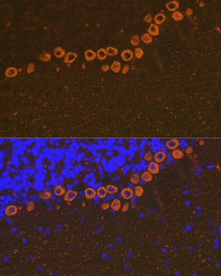 Immunocytochemistry/ Immunofluorescence: IP3R1 Antibody (4Z1B6) [IP3R1] - Immunofluorescence analysis of paraffin-embedded mouse brain using IP3R1 Rabbit mAb  at dilution of 1:100 (40x lens). Secondary antibody: Cy3-conjugated Goat anti-Rabbit IgG (H+L)  at 1:500 dilution. Blue: DAPI for nuclear staining.