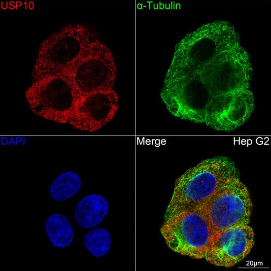 Immunocytochemistry/ Immunofluorescence: USP10 Antibody (9L6F3) [NBP3-16416] - Confocal imaging of Hep G2 cells using USP10 Rabbit mAb . The cells were counterstained with alpha-Tubulin Mouse mAb (Green). DAPI was used for nuclear staining (blue). Objective: 100x.