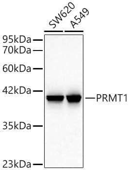 Western Blot: PRMT1 Antibody (10W10U4) [NBP3-16423] - Western blot analysis of various lysates using PRMT1 Rabbit mAb at 1:1000 dilution incubated overnight at 4C.Secondary antibody: HRP-conjugated Goat anti-Rabbit IgG (H+L) at 1:10000 dilution.Lysates/proteins: 25 ug per lane.Blocking buffer: 3% nonfat dry milk in TBST.Detection: ECL Basic Kit.Exposure time: 90s.