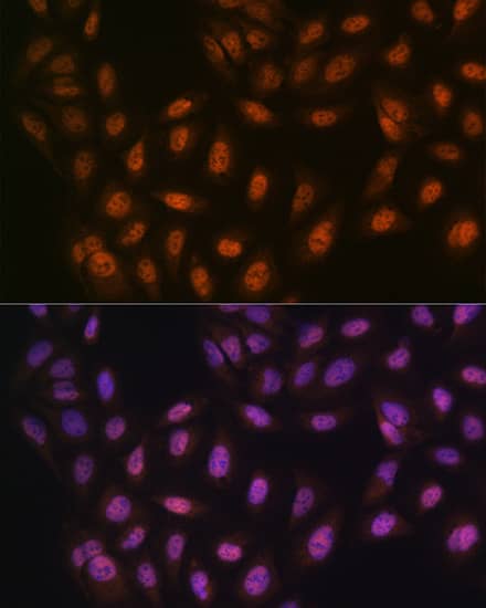 Immunocytochemistry/ Immunofluorescence: PRMT1 Antibody (10W10U4) [NBP3-16423] - Immunofluorescence analysis of U-2 OS cells using PRMT1 Rabbit mAb at dilution of 1:100 (40x lens). Secondary antibody: Cy3-conjugated Goat anti-Rabbit IgG (H+L) at 1:500 dilution. Blue: DAPI for nuclear staining.