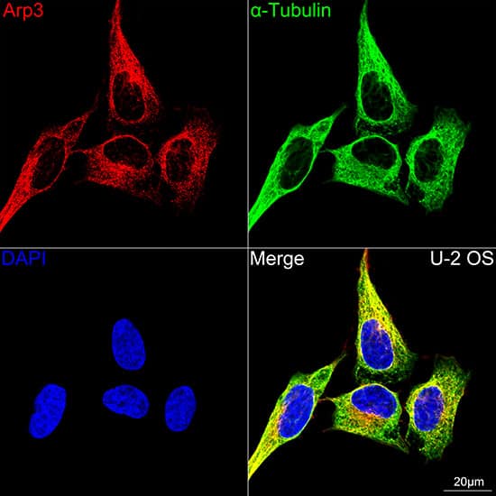 Immunocytochemistry/ Immunofluorescence: ACTR3 Antibody (8K4F2) [NBP3-16424] - Confocal imaging of U-2 OS cells using ACTR3 Rabbit mAb . The cells were counterstained with alpha-Tubulin Mouse mAb  (Green). DAPI was used for nuclear staining (blue). Objective: 100x.