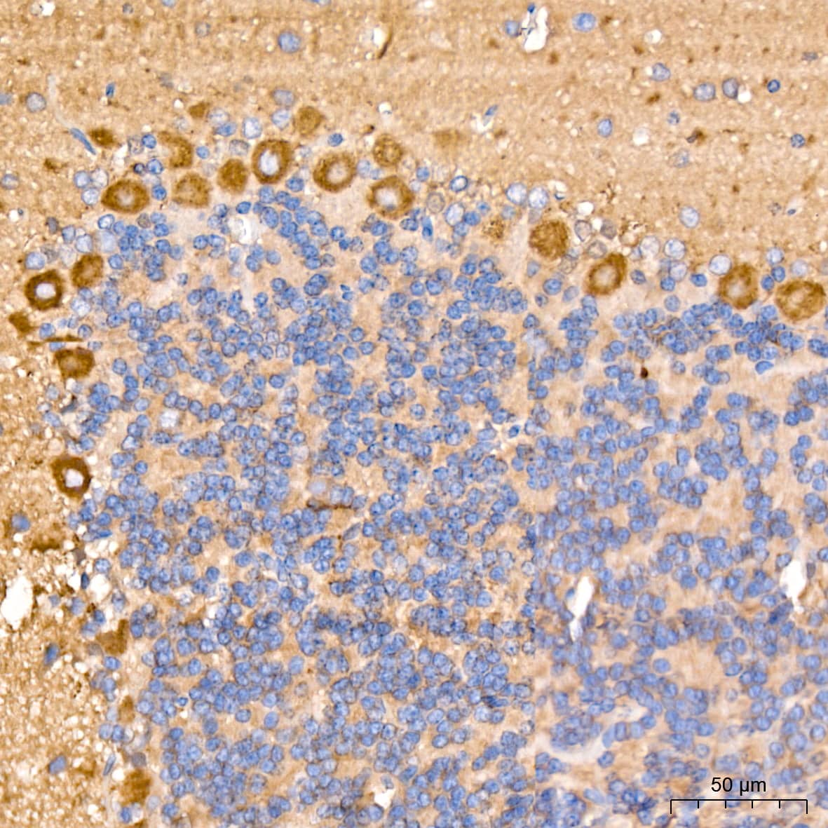 Immunohistochemistry: ACTR3 Antibody (8K4F2) [NBP3-16424] - Immunohistochemistry analysis of ACTR3 in paraffin-embedded rat brain tissue using ACTR3 Rabbit mAb  at a dilution of 1:200 (40x lens).High pressure antigen retrieval was performed with 0.01 M citrate buffer (pH 6.0) prior to IHC staining.