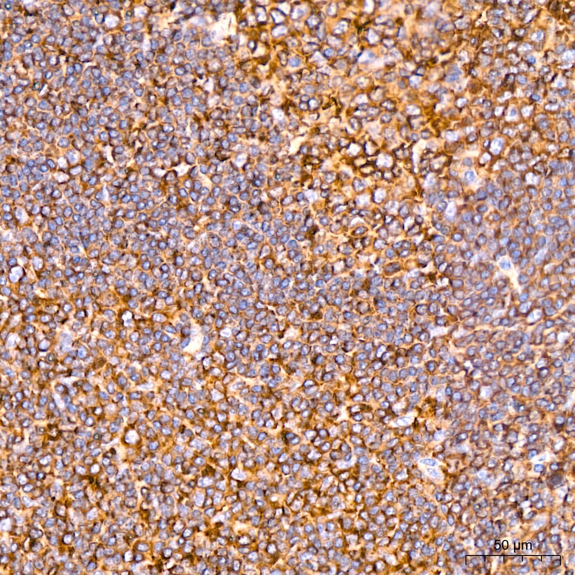 Immunohistochemistry ACTR3 Antibody (8K4F2)