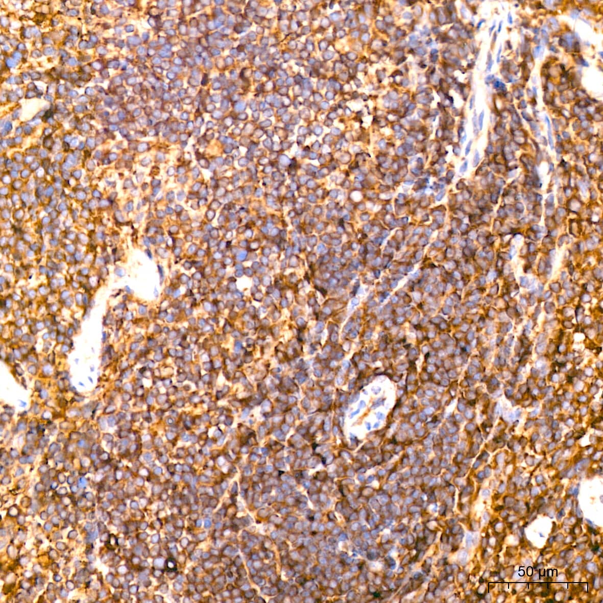 Immunohistochemistry: ACTR3 Antibody (8K4F2) [NBP3-16424] - Immunohistochemistry analysis of ACTR3 in paraffin-embedded mouse spleen tissue using ACTR3 Rabbit mAb  at a dilution of 1:200 (40x lens).High pressure antigen retrieval was performed with 0.01 M citrate buffer (pH 6.0) prior to IHC staining.