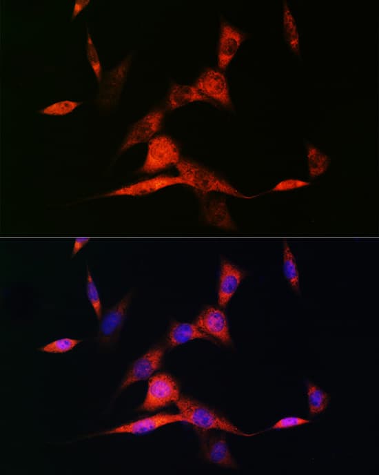 Immunocytochemistry/ Immunofluorescence: RAR beta/NR1B2 Antibody (6D5V4) [NBP3-16428] - Immunofluorescence analysis of NIH-3T3 cells using RAR beta/NR1B2 Rabbit mAb at dilution of 1:100 (40x lens). Secondary antibody: Cy3-conjugated Goat anti-Rabbit IgG (H+L) at 1:500 dilution. Blue: DAPI for nuclear staining.