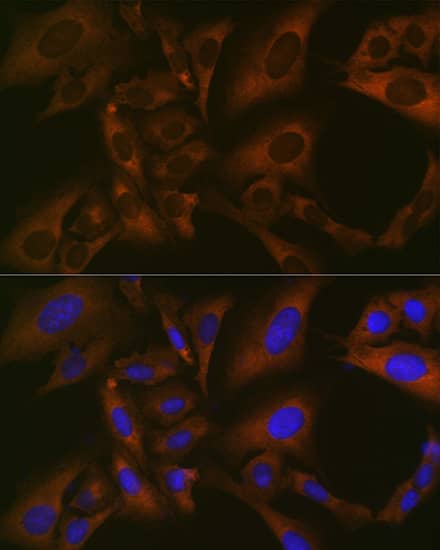 Immunocytochemistry/ Immunofluorescence: BMP-6 Antibody (6N5S9) [BMP-6] - Immunofluorescence analysis of U-2 OS cells using BMP-6 Rabbit mAb  at dilution of 1:100 (40x lens). Secondary antibody: Cy3-conjugated Goat anti-Rabbit IgG (H+L)  at 1:500 dilution. Blue: DAPI for nuclear staining.