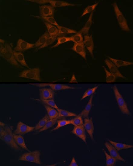 Immunocytochemistry/ Immunofluorescence: BMP-6 Antibody (6N5S9) [BMP-6] - Immunofluorescence analysis of NIH-3T3 cells using BMP-6 Rabbit mAb  at dilution of 1:100 (40x lens). Secondary antibody: Cy3-conjugated Goat anti-Rabbit IgG (H+L)  at 1:500 dilution. Blue: DAPI for nuclear staining.