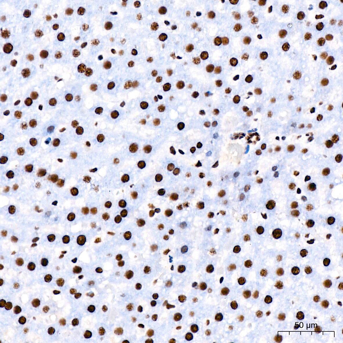 Immunohistochemistry: RNA Helicase A Antibody (2I6C5) [NBP3-16435] - Immunohistochemistry analysis of paraffin-embedded Rat liver using RNA Helicase A Rabbit mAb at dilution of 1:200 (40x lens). High pressure antigen retrieval performed with 0.01M Citrate Bufferr (pH 6.0) prior to IHC staining.