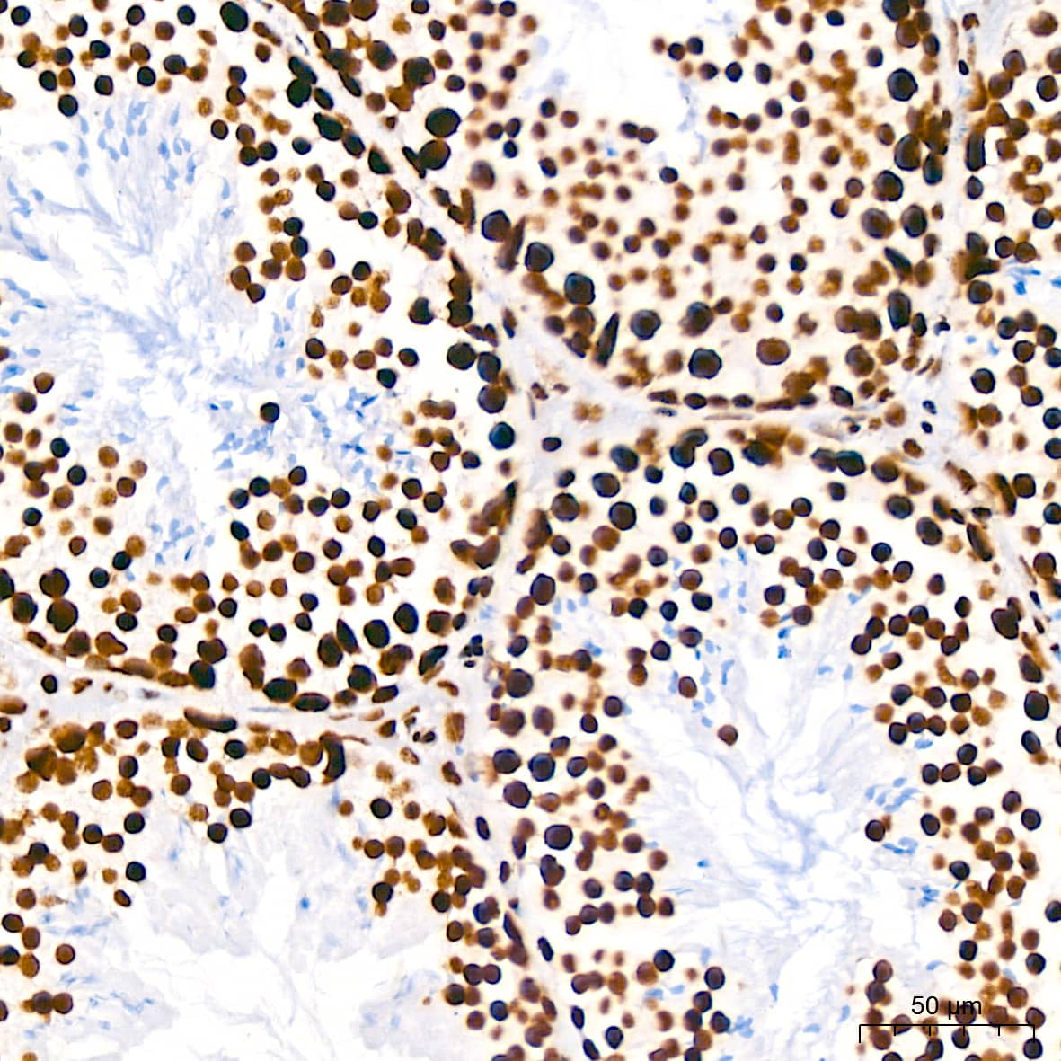 Immunohistochemistry: RNA Helicase A Antibody (2I6C5) [NBP3-16435] - Immunohistochemistry analysis of paraffin-embedded Rat testis using RNA Helicase A Rabbit mAb at dilution of 1:200 (40x lens). High pressure antigen retrieval performed with 0.01M Citrate Bufferr (pH 6.0) prior to IHC staining.