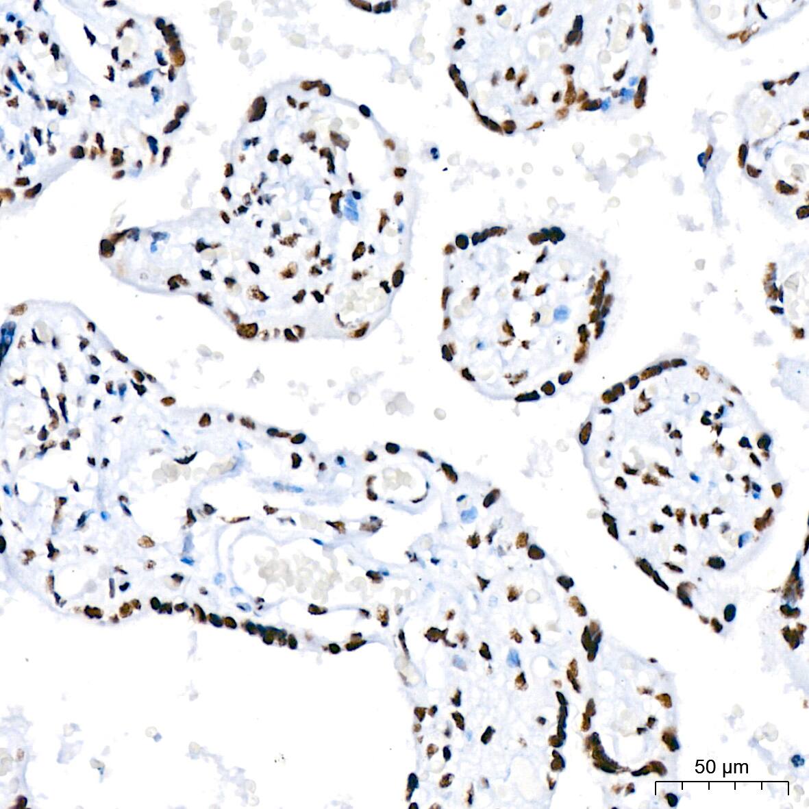 Immunohistochemistry: RNA Helicase A Antibody (2I6C5) [NBP3-16435] - Immunohistochemistry analysis of paraffin-embedded Human placenta using RNA Helicase A Rabbit mAb at dilution of 1:200 (40x lens). High pressure antigen retrieval performed with 0.01M Citrate Bufferr (pH 6.0) prior to IHC staining.