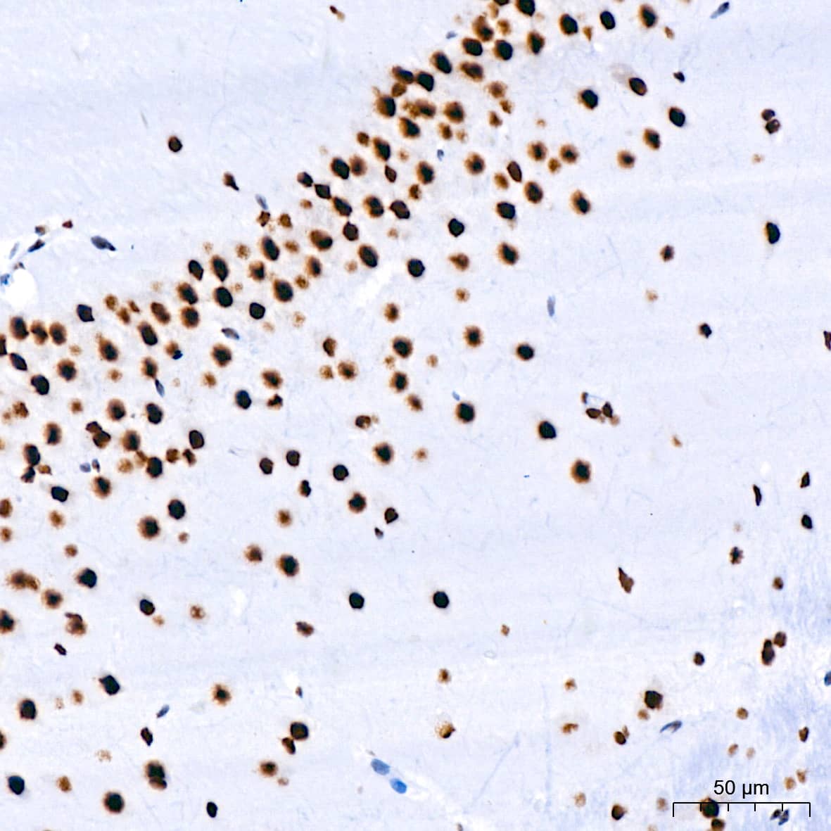 Immunohistochemistry: RNA Helicase A Antibody (2I6C5) [NBP3-16435] - Immunohistochemistry analysis of paraffin-embedded Rat brain using RNA Helicase A Rabbit mAb at dilution of 1:200 (40x lens). High pressure antigen retrieval performed with 0.01M Citrate Bufferr (pH 6.0) prior to IHC staining.