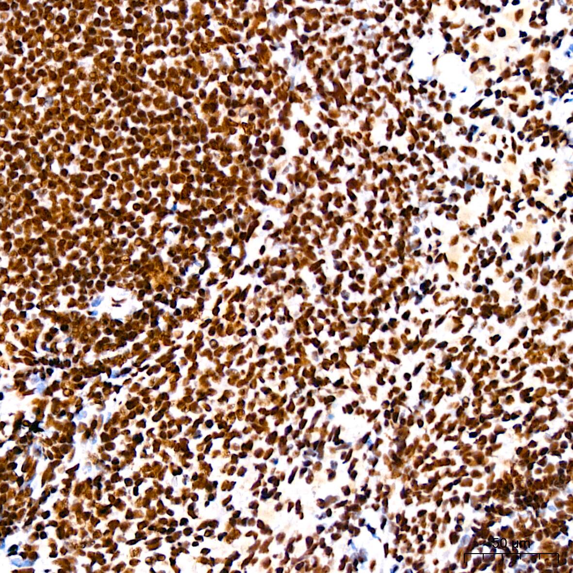 Immunohistochemistry: RNA Helicase A Antibody (2I6C5) [NBP3-16435] - Immunohistochemistry analysis of paraffin-embedded Rat spleen using RNA Helicase A Rabbit mAb at dilution of 1:200 (40x lens). High pressure antigen retrieval performed with 0.01M Citrate Bufferr (pH 6.0) prior to IHC staining.