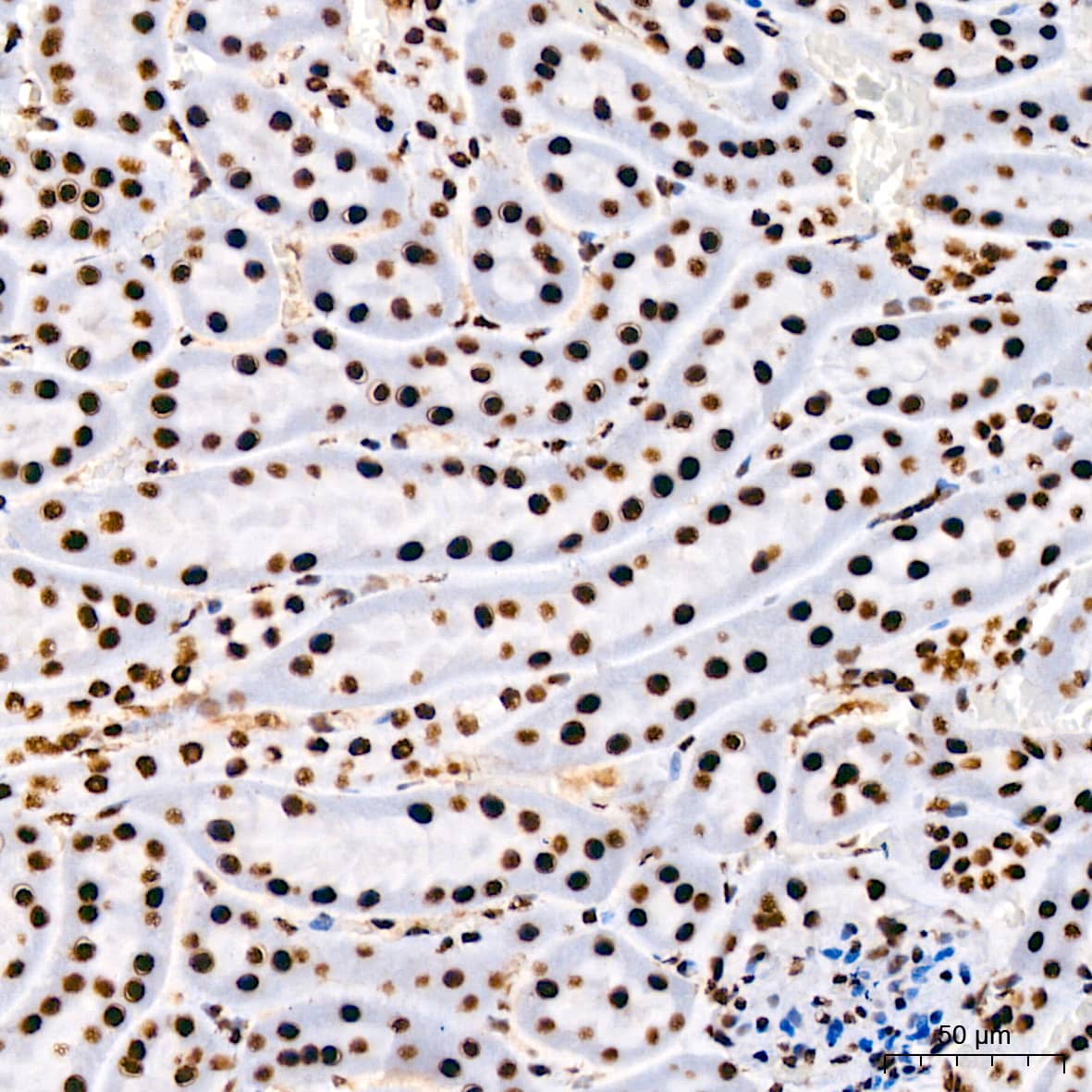 Immunohistochemistry: RNA Helicase A Antibody (2I6C5) [NBP3-16435] - Immunohistochemistry analysis of paraffin-embedded Mouse kidney using RNA Helicase A Rabbit mAb at dilution of 1:200 (40x lens). High pressure antigen retrieval performed with 0.01M Citrate Bufferr (pH 6.0) prior to IHC staining.