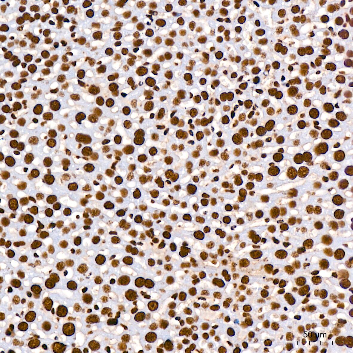 Immunohistochemistry: RNA Helicase A Antibody (2I6C5) [RNA Helicase A] - Immunohistochemistry analysis of paraffin-embedded Mouse liver using RNA Helicase A Rabbit mAb  at dilution of 1:200 (40x lens). High pressure antigen retrieval performed with 0.01M Citrate Bufferr (pH 6.0) prior to IHC staining.