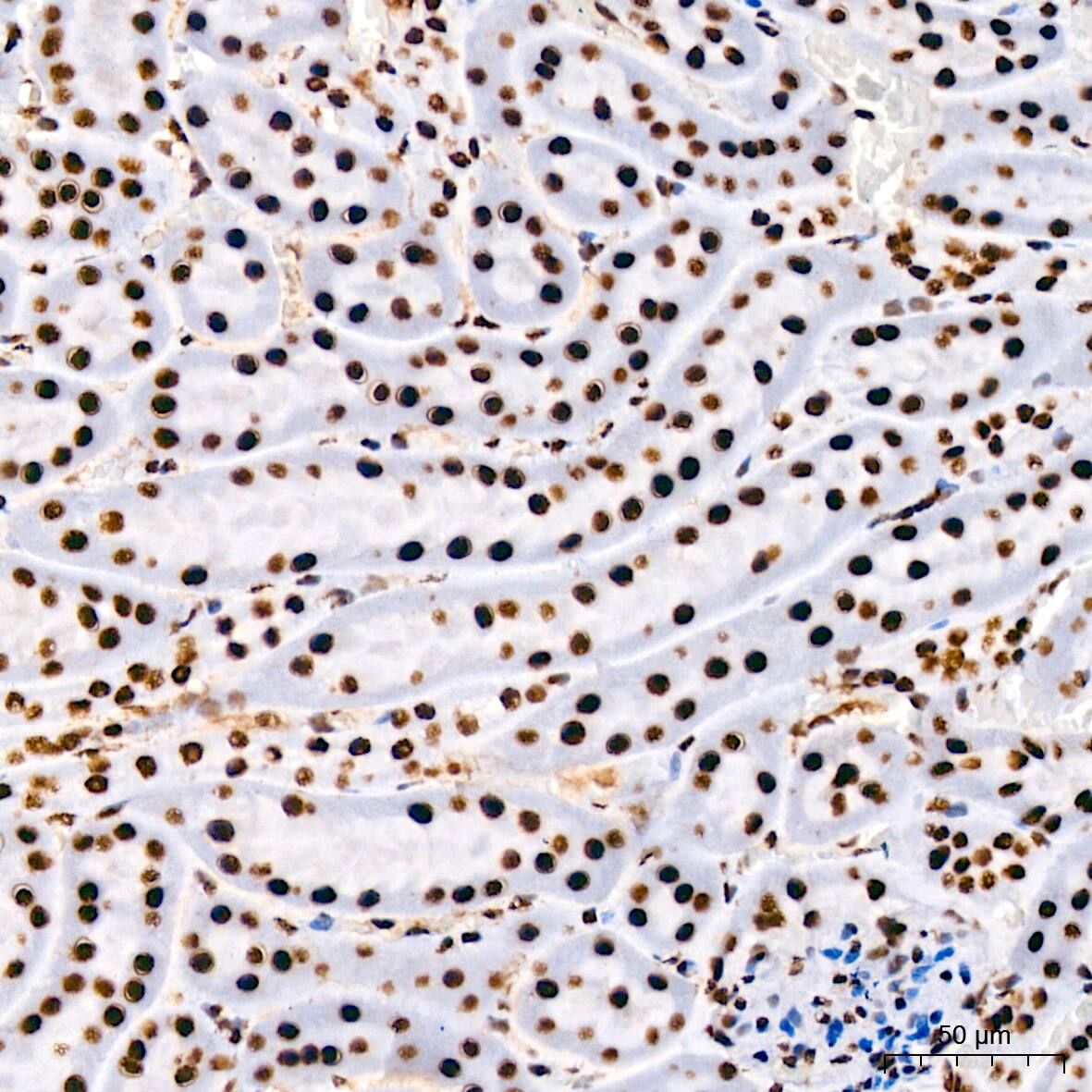 Immunohistochemistry: RNA Helicase A Antibody (2I6C5) [RNA Helicase A] - Immunohistochemistry analysis of paraffin-embedded Mouse kidney using RNA Helicase A Rabbit mAb  at dilution of 1:200 (40x lens). High pressure antigen retrieval performed with 0.01M Citrate Bufferr (pH 6.0) prior to IHC staining.