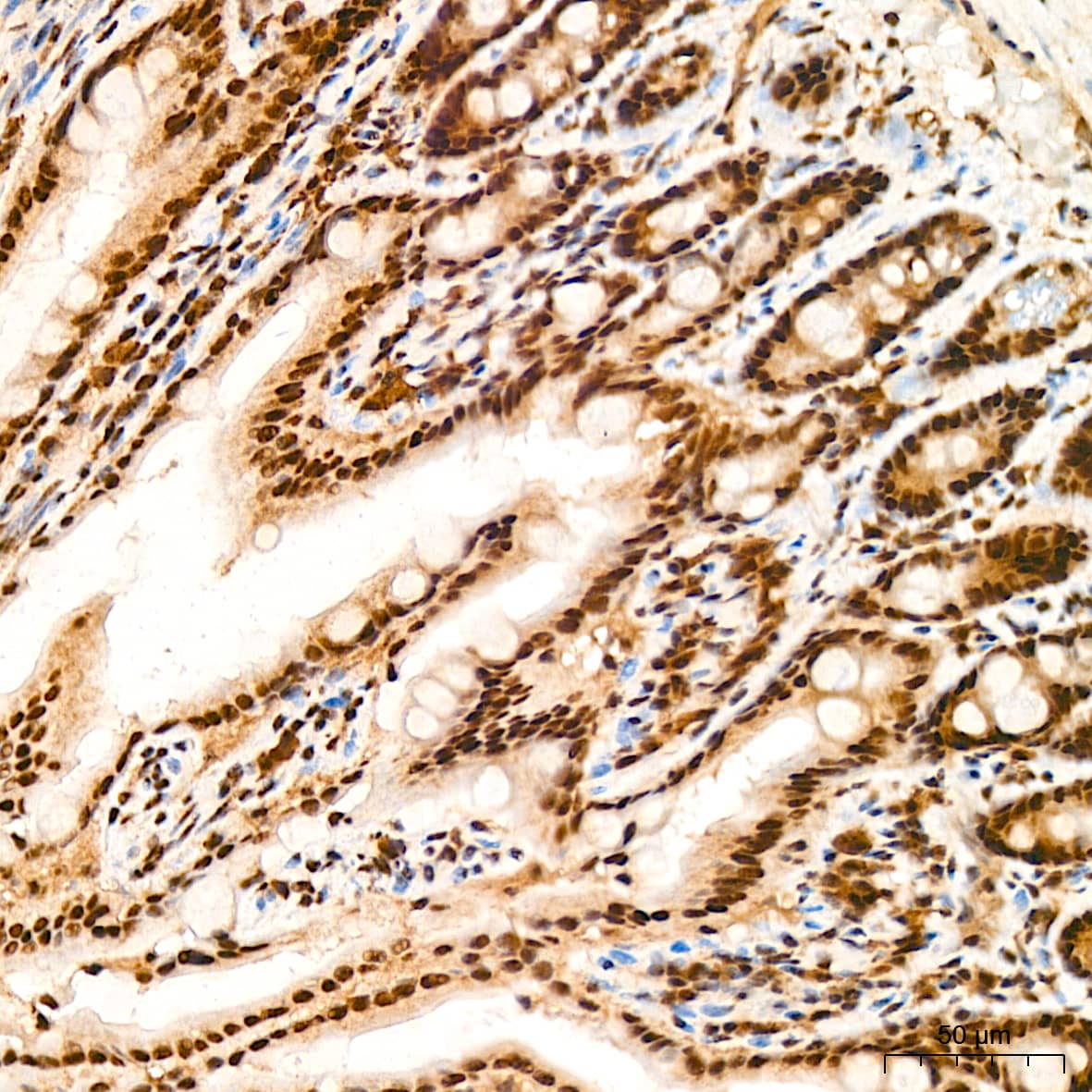 Immunohistochemistry: PRPF8 Antibody (4I1Q8) [NBP3-16440] - Immunohistochemistry analysis of PRPF8 in paraffin-embedded mouse colon tissue using PRPF8 Rabbit mAb  at a dilution of 1:200 (40x lens). High pressure antigen retrieval was performed with 0.01 M citrate buffer (pH 6.0) prior to IHC staining.