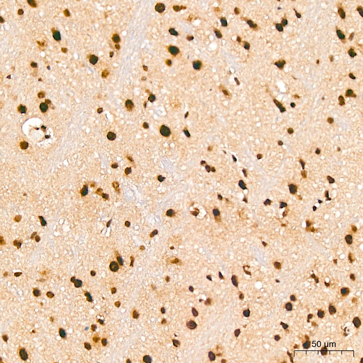 Immunohistochemistry PRPF8 Antibody (4I1Q8)