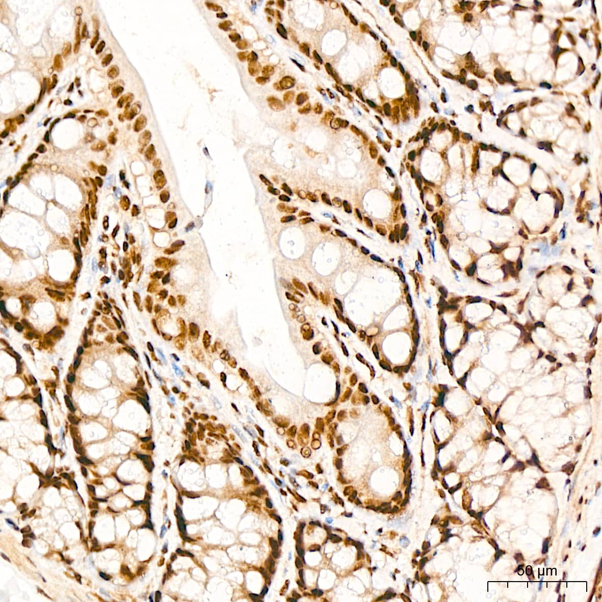 Immunohistochemistry: PRPF8 Antibody (4I1Q8) [NBP3-16440] - Immunohistochemistry analysis of PRPF8 in paraffin-embedded rat colon tissue using PRPF8 Rabbit mAb  at a dilution of 1:200 (40x lens). High pressure antigen retrieval was performed with 0.01 M citrate buffer (pH 6.0) prior to IHC staining.