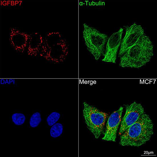 Immunocytochemistry/ Immunofluorescence: IGFBP-rp1/IGFBP-7 Antibody (8M10Q9) [NBP3-16449] - Confocal imaging of MCF7 cells using IGFBP-rp1/IGFBP-7 Rabbit mAb . The cells were counterstained with alpha-Tubulin Mouse mAb (Green). DAPI was used for nuclear staining (blue). Objective: 100x.