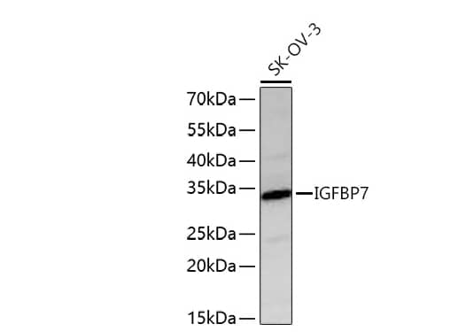 Analysis of lysates from SK-OV-3 cells using IGFBP7 Rabbit mAb at 1:6000 dilution incubated overnight at 4℃.Secondary antibody: HRP-conjugated Goat anti-Rabbit IgG (H+L) at 1:10000 dilution.Lysates/proteins: 25 μg per lane.Blocking buffer: 3% nonfat dry milk in TBST.Detection: ECL Basic Kit. Exposure time: 90 s.