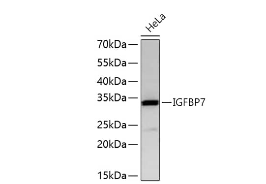  Analysis of lysates from HeLa cells using IGFBP7 Rabbit mAb at 1:6000 dilution incubated overnight at 4℃.Secondary antibody: HRP-conjugated Goat anti-Rabbit IgG (H+L) at 1:10000 dilution.Lysates/proteins: 25 μg per lane.Blocking buffer: 3% nonfat dry milk in TBST.Detection: ECL Basic Kit. Exposure time: 30 s.