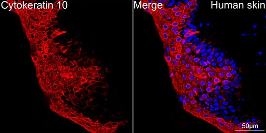 Immunocytochemistry/ Immunofluorescence: Cytokeratin 10 Antibody (4S5Y7) [NBP3-16460] - Confocal imaging of paraffin-embedded Human skin using Cytokeratin 10 Rabbit mAb followed by a further incubation with Cy3 Goat Anti-Rabbit IgG (H+L) . DAPI was used for nuclear staining (Blue). Objective: 40x.Perform high pressure antigen retrieval with 0.01M citrate buffer (pH 6.0) prior to IF staining.