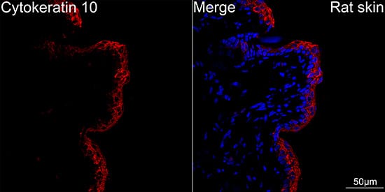 Immunocytochemistry/ Immunofluorescence: Cytokeratin 10 Antibody (4S5Y7) [NBP3-16460] - Confocal imaging of paraffin-embedded Rat skin using Cytokeratin 10 Rabbit mAb followed by a further incubation with Cy3 Goat Anti-Rabbit IgG (H+L) . DAPI was used for nuclear staining (Blue). Objective: 40x.Perform high pressure antigen retrieval with 0.01M citrate buffer (pH 6.0) prior to IF staining.