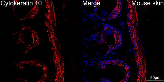 Immunocytochemistry/ Immunofluorescence: Cytokeratin 10 Antibody (4S5Y7) [Cytokeratin 10] - Confocal imaging of paraffin-embedded Mouse skin using Cytokeratin 10 Rabbit mAb  followed by a further incubation with Cy3 Goat Anti-Rabbit IgG (H+L)  . DAPI was used for nuclear staining (Blue). Objective: 40x.Perform high pressure antigen retrieval with 0.01M citrate buffer (pH 6.0) prior to IF staining.