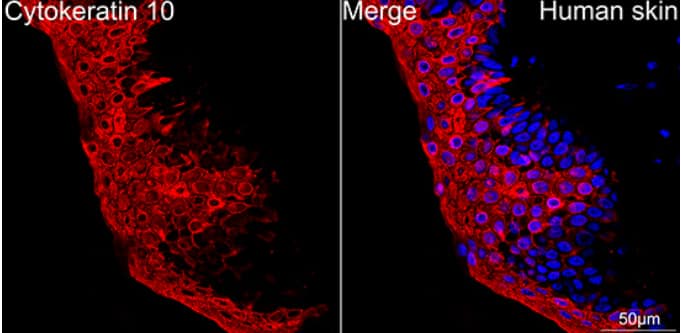 Immunohistochemistry-Paraffin: Cytokeratin 10 Antibody (4S5Y7) [NBP3-16460] - Confocal imaging of paraffin-embedded Human skin using Cytokeratin 10 Rabbit mAb (dilution 1:200) followed by a further incubation with Cy3 Goat Anti-Rabbit IgG (H+L) (dilution 1:500) (Red). DAPI was used for nuclear staining (Blue). Objective: 40x.Perform high pressure antigen retrieval with 0.01M citrate buffer (pH 6.0) prior to IF staining.