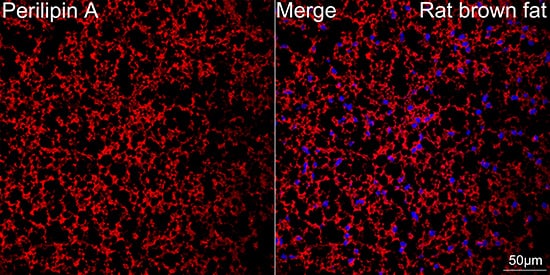 Immunocytochemistry/ Immunofluorescence: Perilipin Antibody (1K4W3) [NBP3-16480] - Confocal imaging of paraffin-embedded Rat brown fat tissue using Perilipin Rabbit mAb followed by a further incubation with Cy3 Goat Anti-Rabbit IgG (H+L). DAPI was used for nuclear staining (Blue). Objective: 40x. Perform high pressure antigen retrieval with 0.01 M citrate buffer (pH 6.0) prior to IF staining.