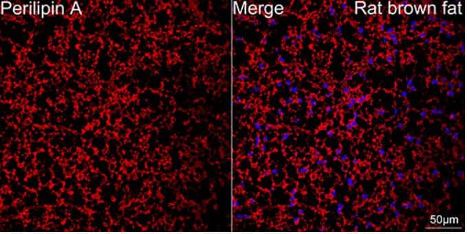 Immunohistochemistry-Paraffin: Perilipin Antibody (1K4W3) [NBP3-16480] - Confocal imaging of paraffin-embedded Rat brown fat tissue using Perilipin A Rabbit mAb (dilution 1:100) followed by a further incubation with Cy3 Goat Anti-Rabbit IgG (H+L) ( dilution 1:500) (Red). DAPI was used for nuclear staining (Blue). Objective: 40x. Perform high pressure antigen retrieval with 0.01 M citrate buffer (pH 6.0) prior to IF staining.