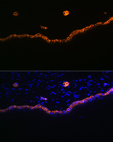 Immunocytochemistry/ Immunofluorescence: Cytokeratin 15 Antibody (9F9F0) [NBP3-16492] - Immunofluorescence analysis of rat skin using Cytokeratin 15 (KRT15) Rabbit mAb at dilution of 1:100 (40x lens). Blue: DAPI for nuclear staining.