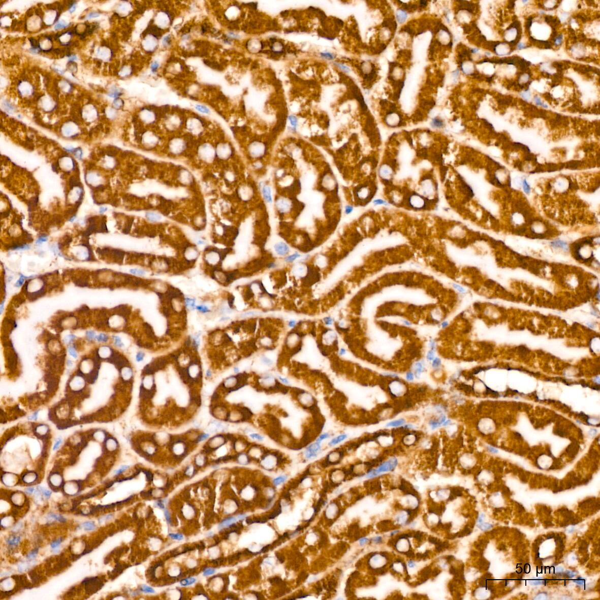 Immunohistochemistry: PBR Antibody (4I9K6) [NBP3-16497] - Immunohistochemistry analysis of paraffin-embedded Mouse kidney tissue using PBR Rabbit mAb at a dilution of 1:200 (40x lens). High pressure antigen retrieval performed with 0.01M Citrate Buffer (pH 6.0) prior to IHC staining.