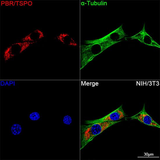 Immunocytochemistry/ Immunofluorescence: PBR Antibody (4I9K6) [NBP3-16497] - Confocal imaging of NIH/3T3 cells using PBR Rabbit mAb. The cells were counterstained with alpha-Tubulin Mouse mAb (Green). DAPI was used for nuclear staining (blue). Objective: 100x.