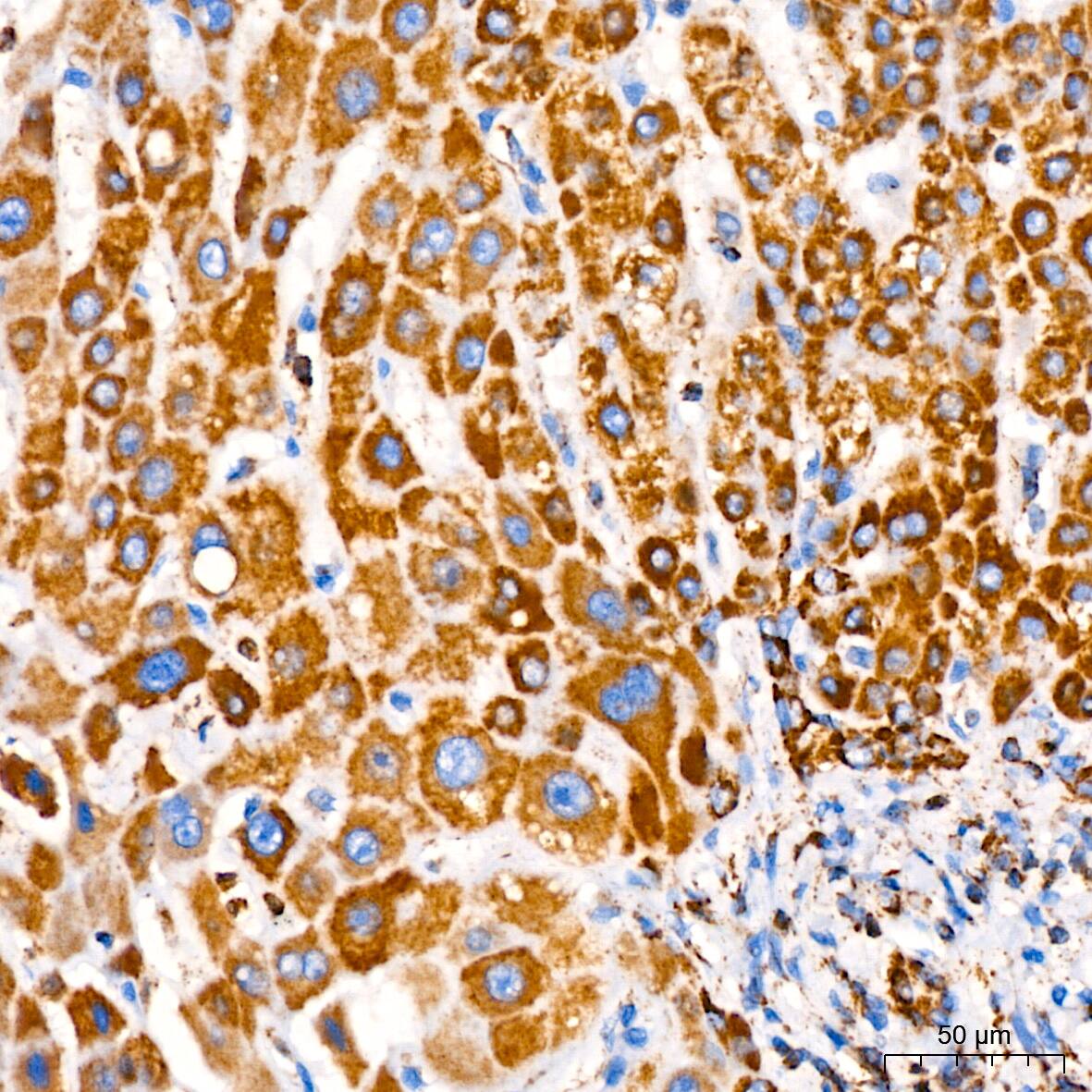 Immunohistochemistry: PBR Antibody (4I9K6) [PBR] - Immunohistochemistry analysis of paraffin-embedded Human liver tissue using PBR Rabbit mAb  at a dilution of 1:200 (40x lens). High pressure antigen retrieval performed with 0.01M Citrate Buffer (pH 6.0) prior to IHC staining.