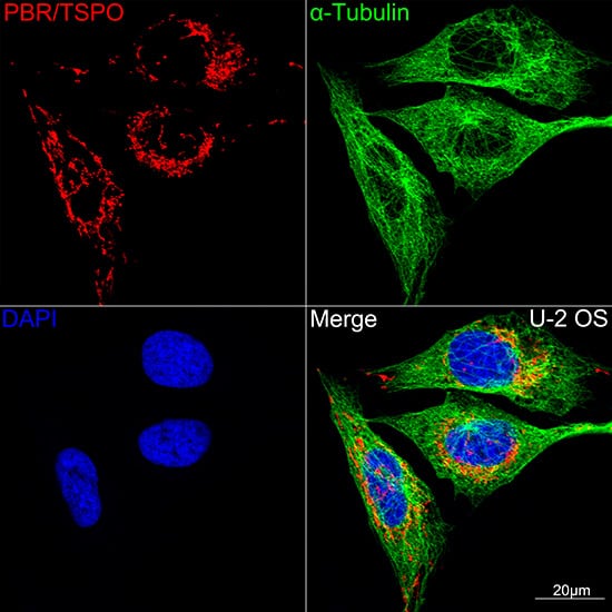 Immunocytochemistry/ Immunofluorescence: PBR Antibody (4I9K6) [PBR] - Confocal imaging of U-2 OS cells using PBR Rabbit mAb . The cells were counterstained with alpha-Tubulin Mouse mAb  (Green). DAPI was used for nuclear staining (blue). Objective: 100x.