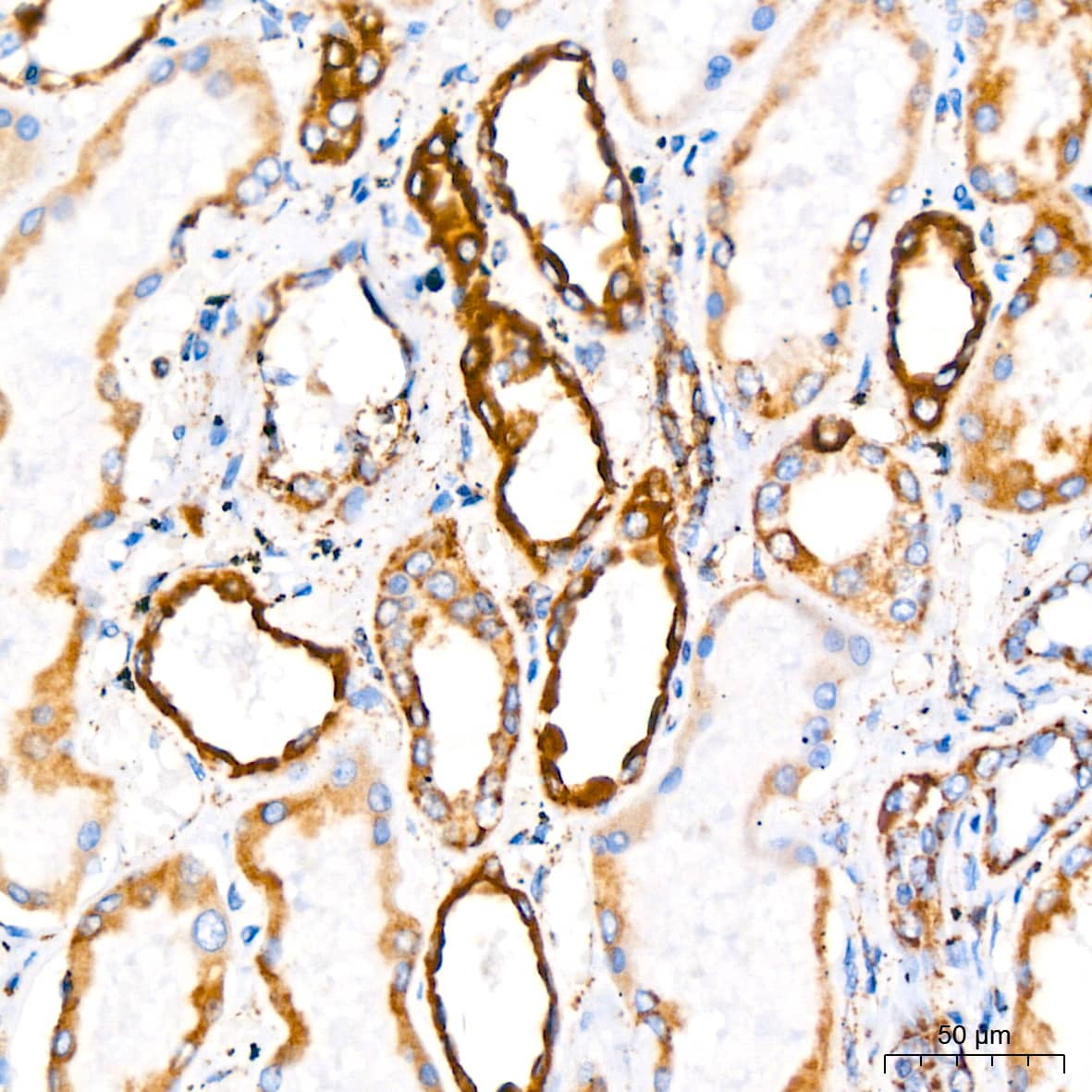 Immunohistochemistry: PBR Antibody (4I9K6) [PBR] - Immunohistochemistry analysis of paraffin-embedded Human kidney tissue using PBR Rabbit mAb  at a dilution of 1:200 (40x lens). High pressure antigen retrieval performed with 0.01M Citrate Buffer (pH 6.0) prior to IHC staining.