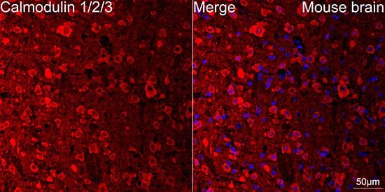 Immunocytochemistry/ Immunofluorescence: Calmodulin Antibody (10W3Y7) [Calmodulin] - Confocal imaging of paraffin-embedded Mouse brain using Calmodulin Rabbit mAb  followed by a further incubation with Cy3 Goat Anti-Rabbit IgG (H+L)  . DAPI was used for nuclear staining (Blue). Objective: 40x. Perform microwave antigen retrieval with 0.01 M citrate buffer (pH 6.0) prior to IF staining.