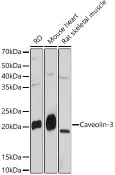 Western Blot: Caveolin-3 Antibody (4G5W2) [NBP3-16503] - Western blot analysis of various lysates, using Caveolin-3Rabbit mAb at 1:1000 dilution.Secondary antibody: HRP-conjugated Goat anti-Rabbit IgG (H+L) at 1:10000 dilution.Lysates/proteins: 25ug per lane.Blocking buffer: 3% nonfat dry milk in TBST.Detection: ECL Basic Kit.Exposure time: 180s.